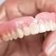 Dentiera per anziani