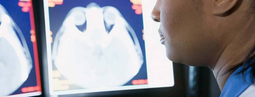 Badanti alzheimer preoccupa