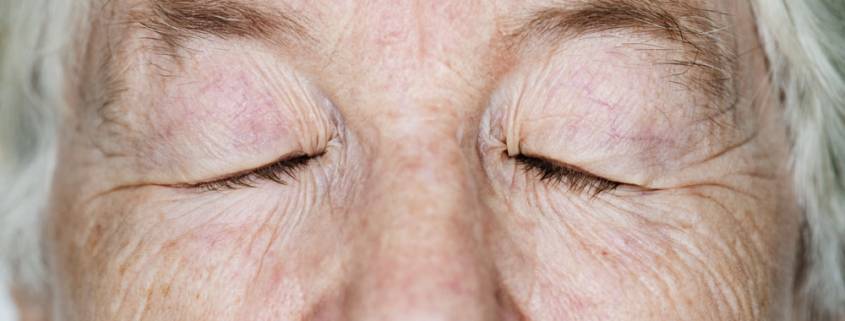 aes domicilio cataratta anziani