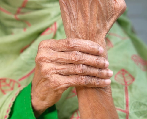 artrite reumatoide anziani aiuto badante
